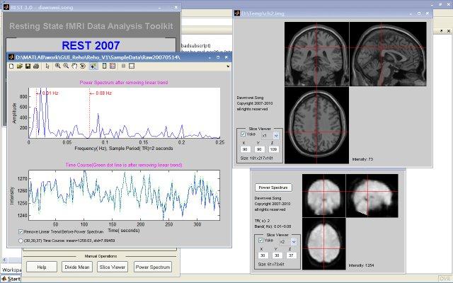 Resting state fMRI data analysis toolkit